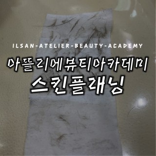 스킨플래닝