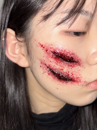 상처분장